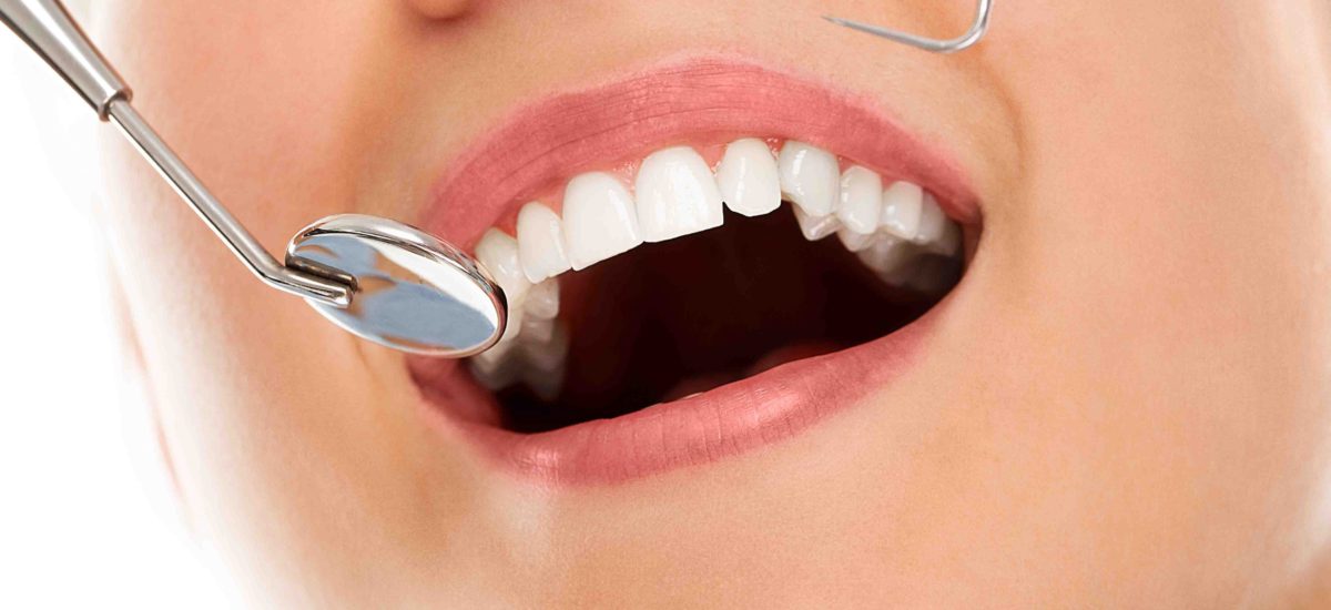 Cómo restaurar dientes desgastados