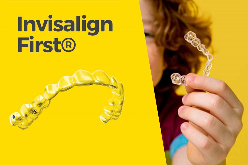 Invisalign First en Córdoba para niños de entre 6 y 10 años